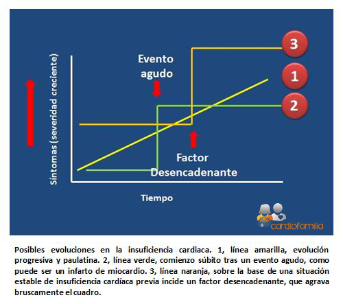 Formas de presentación de la insuficiencia cardiaca Formas presentacion insuficiencia cardiacax580