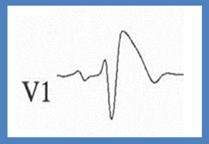 ECG ED15 Cardiofamilia resp