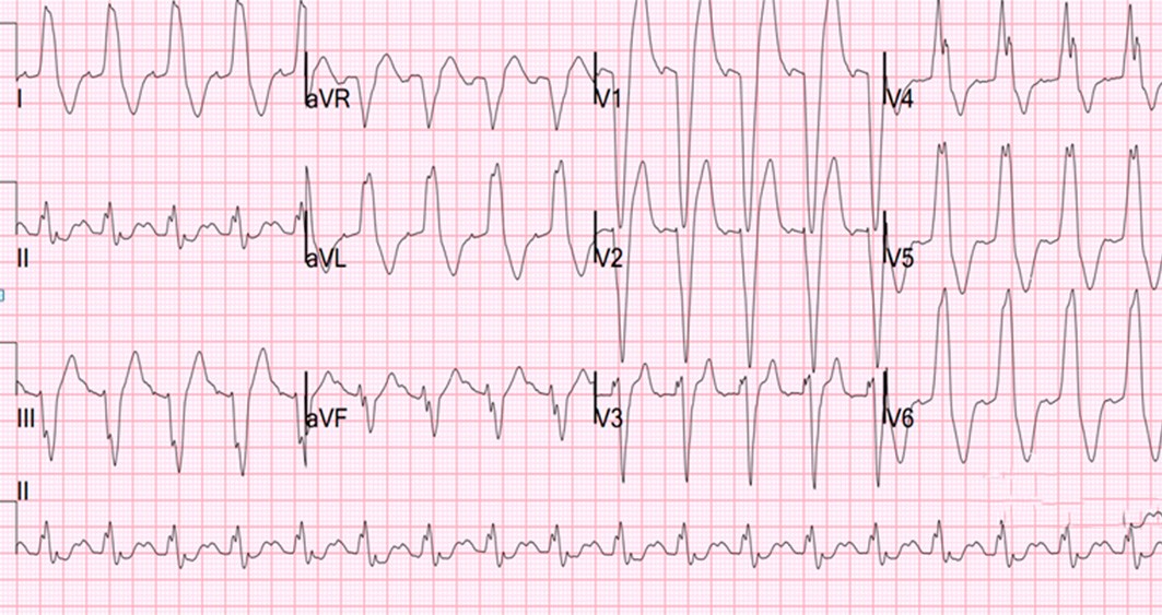 ECG14 2018 cardiofamilia