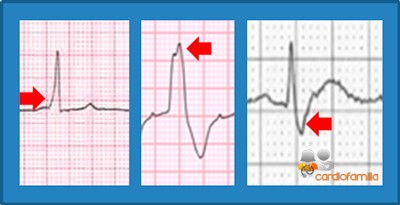 ECG14 2018 cardiofamilia 2 1