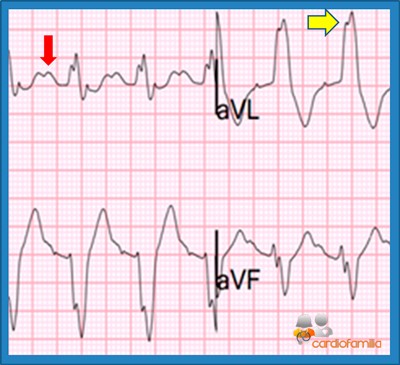 ECG14 2018 cardiofamilia 3 1