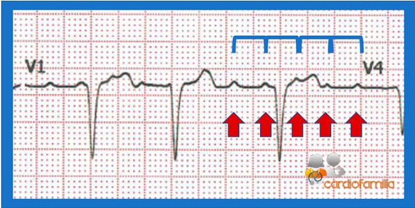 ECG 2.1