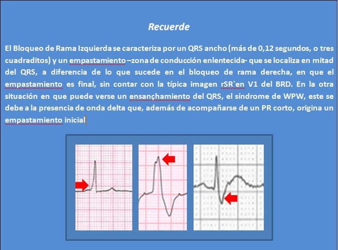 Resincro BRI Respuesta 1