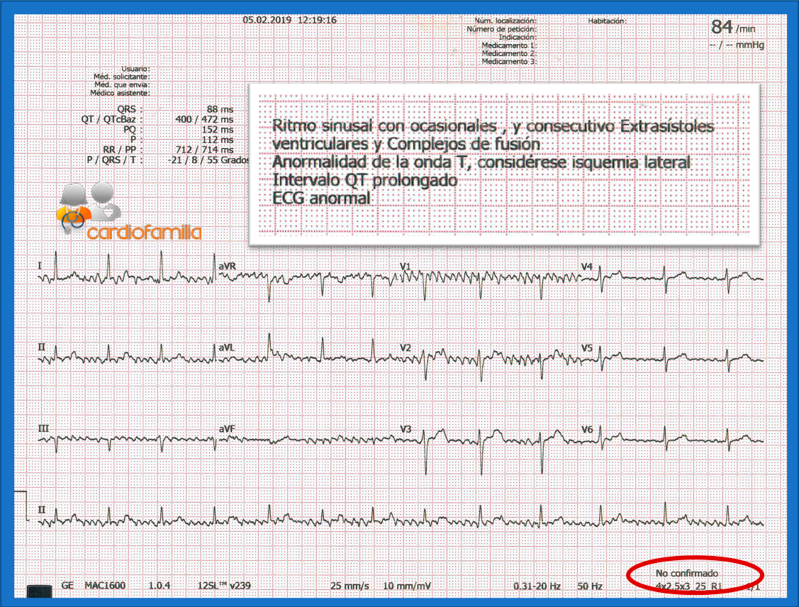 ecg cardiofamilia 11.062020 2