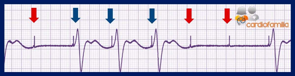 marc disf2 cardiofamilia