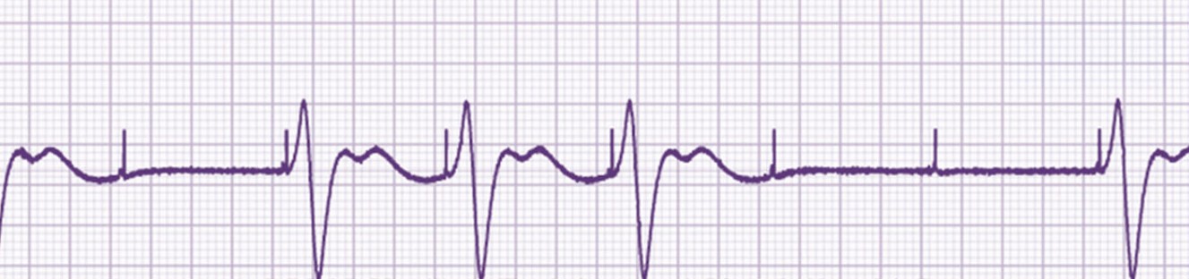 A la vista de este ECG, le parece que